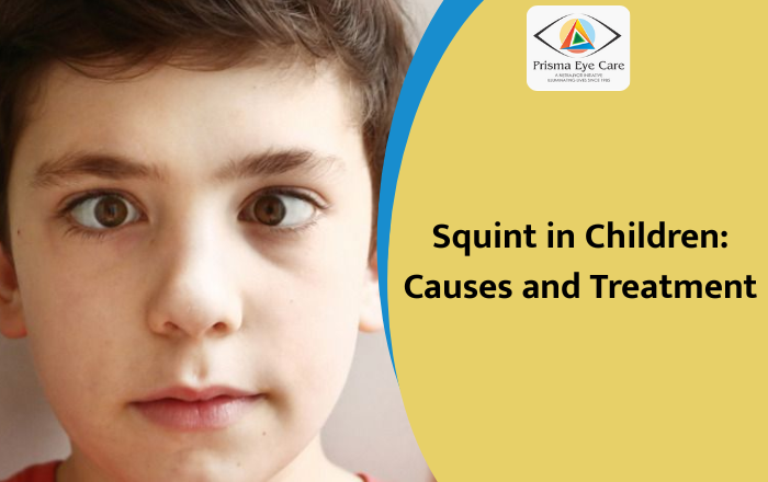 What Causes Squint Eyes in Children, and How Can It Be Treated?
