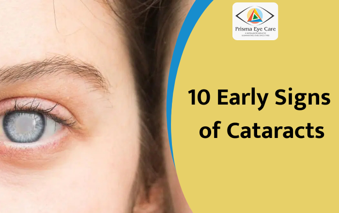 10 Early Signs Of Cataracts You Shouldn’t Ignore