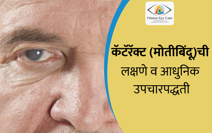 कॅटॅरॅक्ट (मोतीबिंदू) ची लक्षणे व आधुनिक उपचारपद्धती