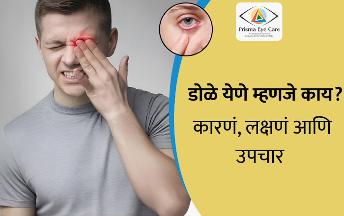 डोळे येणे म्हणजे काय? कारणं, लक्षणं आणि उपचार